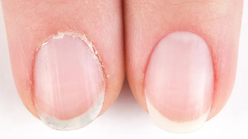 Cuticle Oil