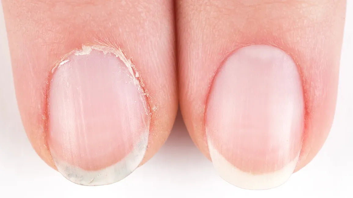 Cuticle Oil